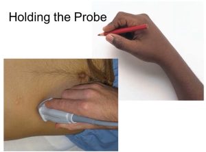 Holding an ultrasound probe